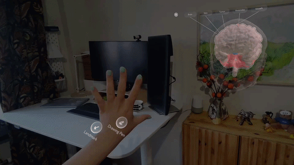 Surgery Planner preview